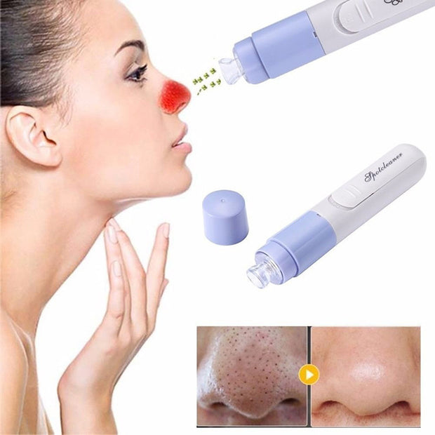 Cleaner Vacuum Suction Facia Blackhead Removal Skin Care Cleansing Tool